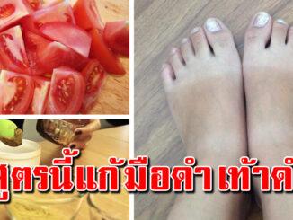 เคล็ดลับแก้มือดำ เท้าดำ ขาวไว ได้ด้วย 8 สูตรบำรุง